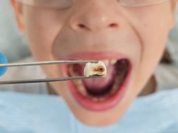Emergency Dentist for Kids in ID